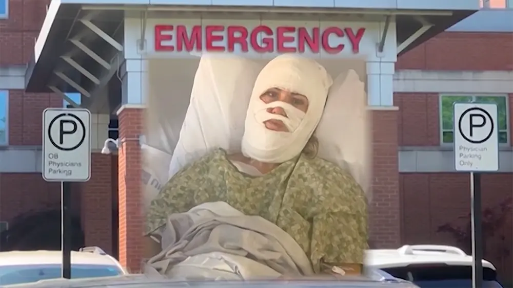 Forsyth Park acid attack victim undergoes first skin graft surgery as fundraising efforts continue