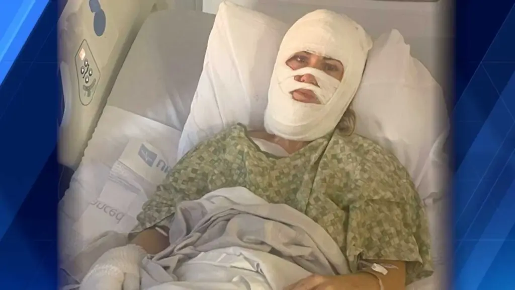 New Details: Witness describes what he saw and heard the night of Forsyth Park acid attack