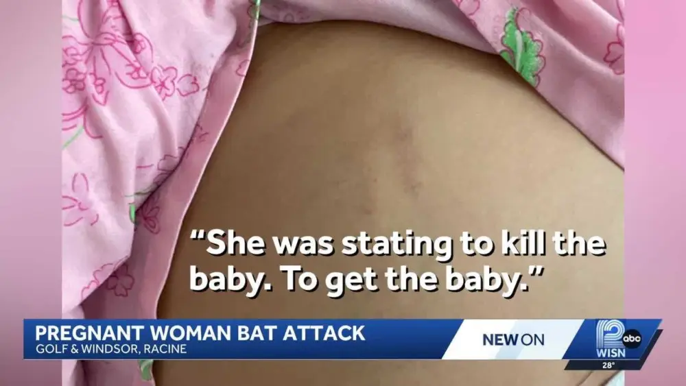 Pregnant woman attacked with bat while leaving work