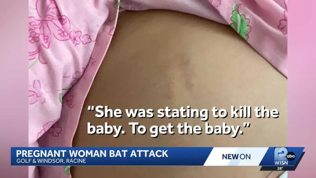 Pregnant woman attacked with bat while leaving work