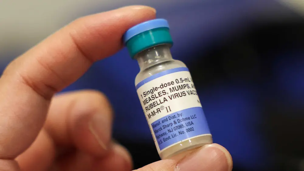 It's not just measles. Mumps are on the rise, too. A doctor explains the concerns