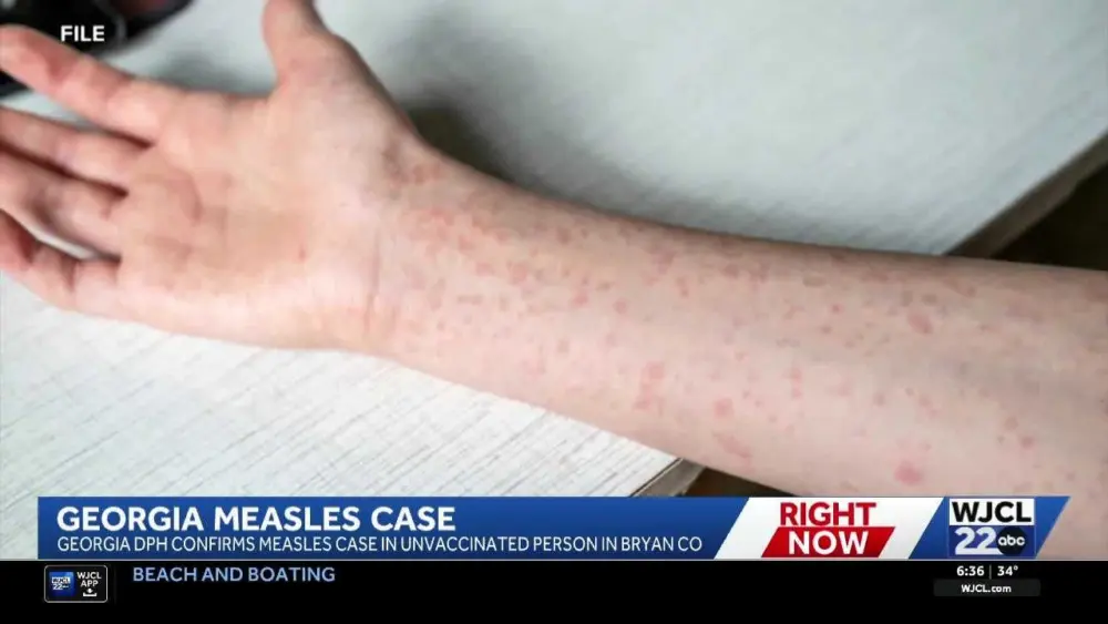 South Carolina lawmakers stop a bill to remove religious exemptions for vaccines