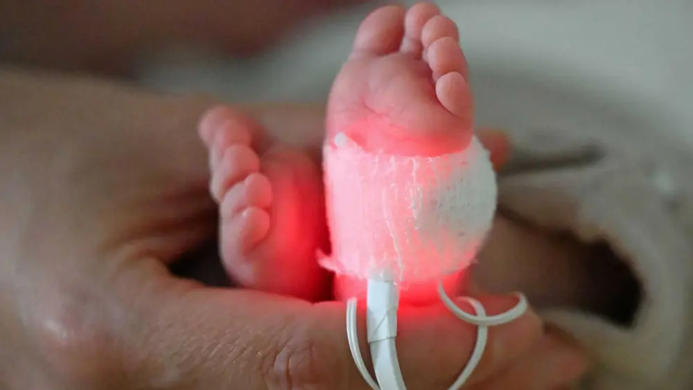 Millions of preterm births and thousands of infant deaths linked to plastic chemical