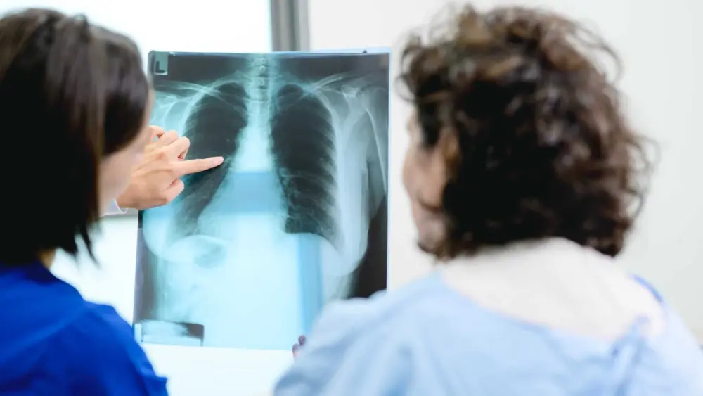 AI tool predicts lung cancer risk years in advance