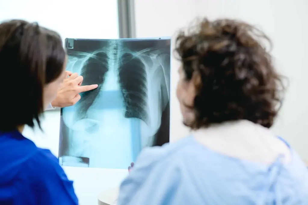 AI tool predicts lung cancer risk years in advance