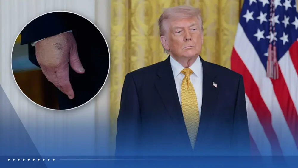 Trump is getting another medical checkup at the end of May, the White House says