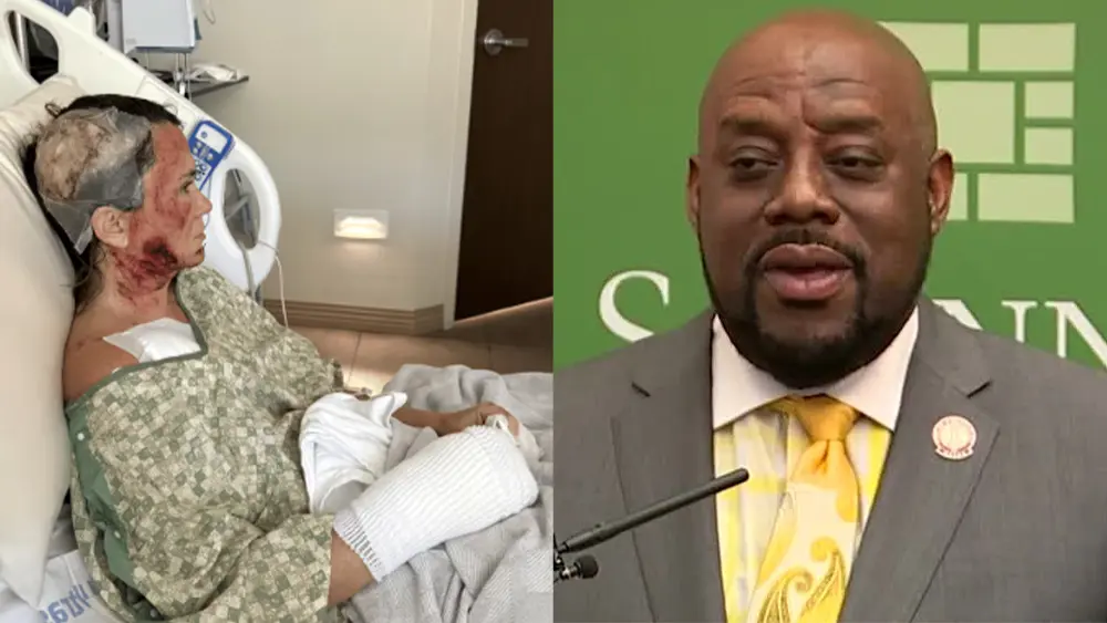 Savannah acid attack victim criticizes mayor over comments, police for withholding information
