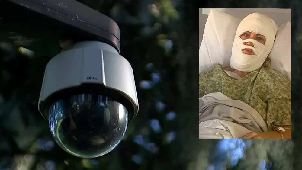 New security cameras installed at Forsyth Park amid acid attack investigation