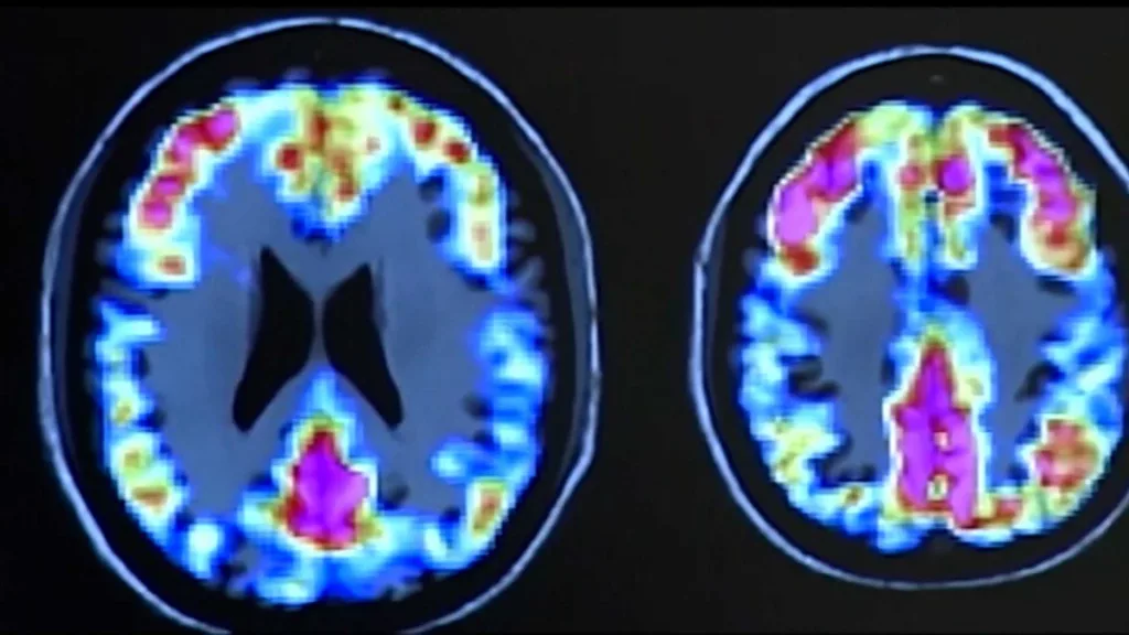 brains-66b93dfb17b86566250