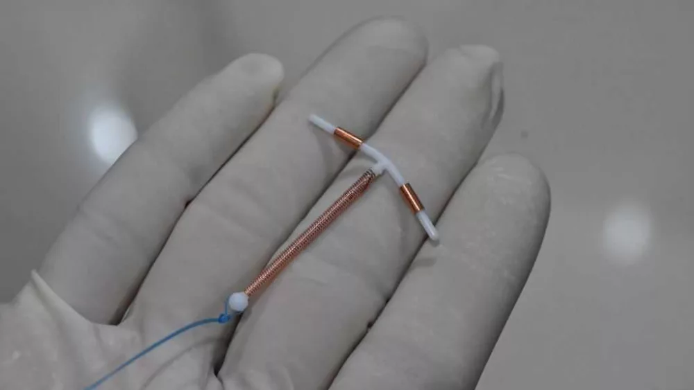 Getting an IUD can hurt. New guidelines say doctors should help patients manage the pain