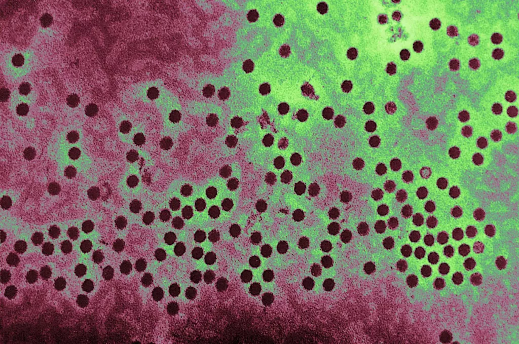 Common respiratory virus is on the rise, CDC warns, with higher risk for certain groups