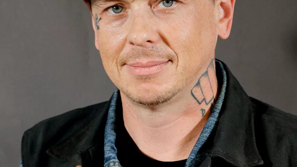 Slipknot band member Sid Wilson 'sustained burns across his body' in an accident