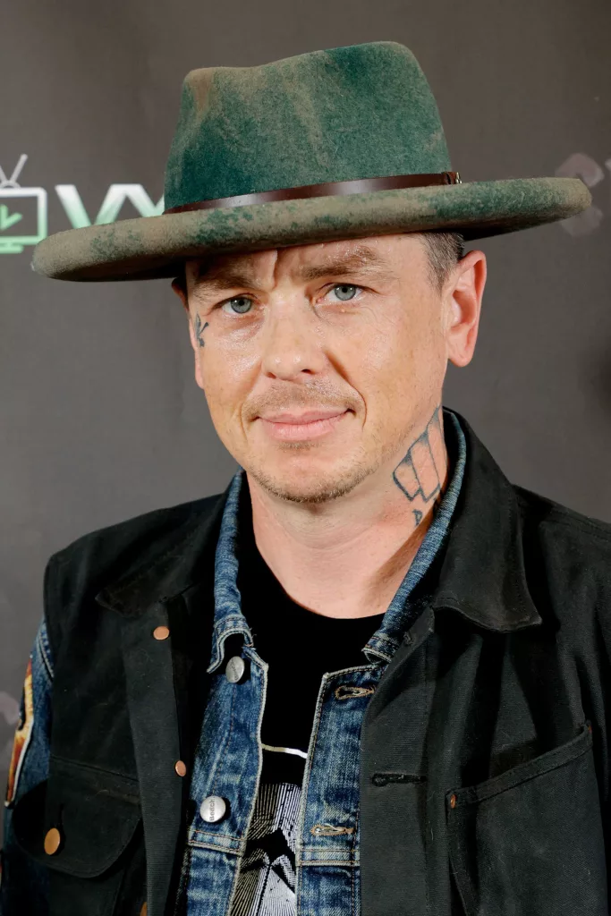 Slipknot band member Sid Wilson 'sustained burns across his body' in an accident