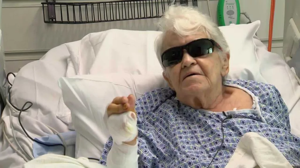 84-year-old Florida woman fights gator and shares her story