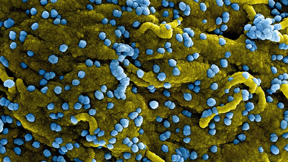 CDC will start screening travelers from Rwanda to the US for Marburg virus