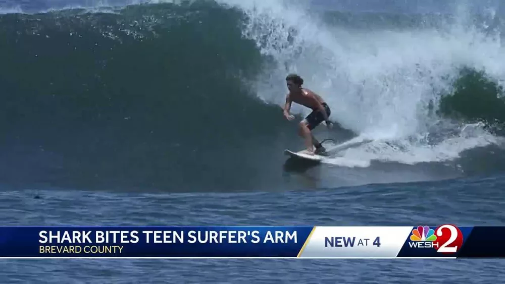 'I felt this pressure on my arm': Teen survives shark bite at a Florida beach