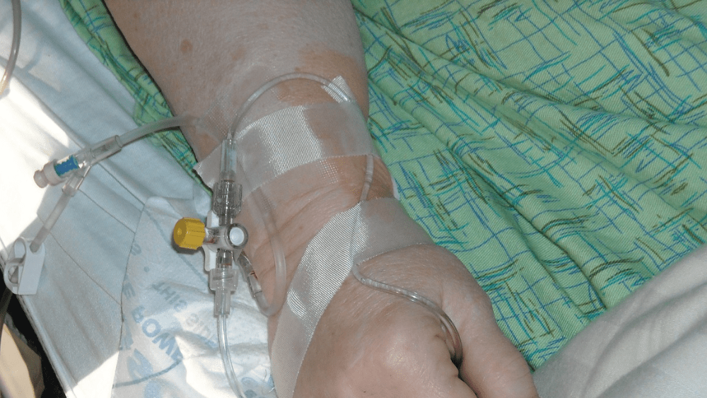 IV line placed in a person's hand