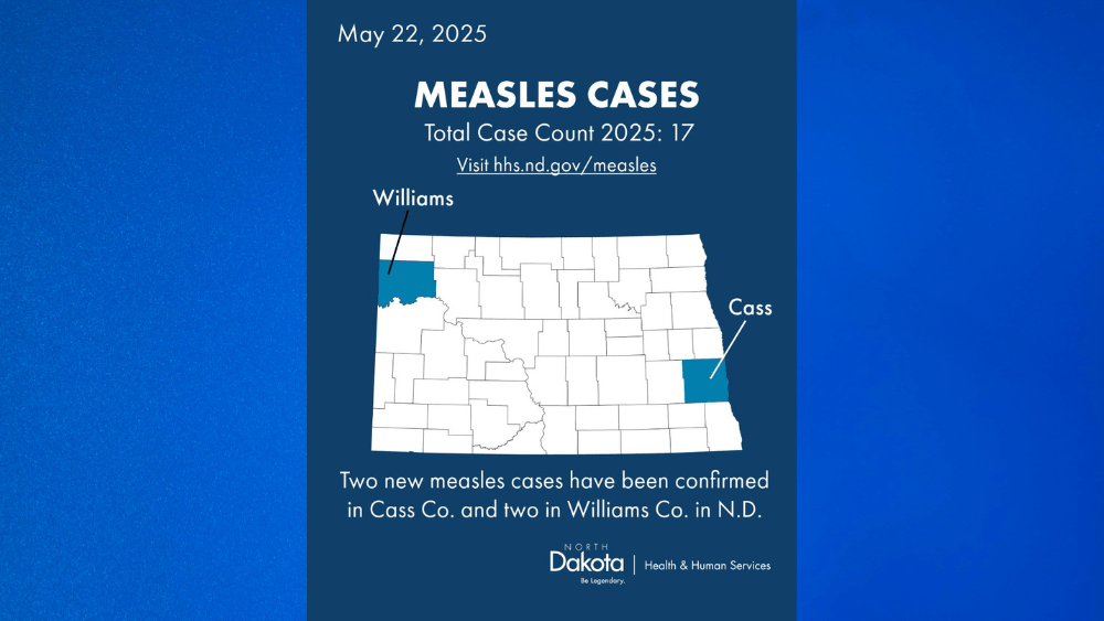 Measles