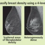 Daviess Community Hospital Promotes 3D Mammography