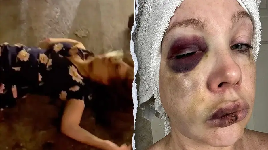 cincinnati-brawl-victim-holly452504