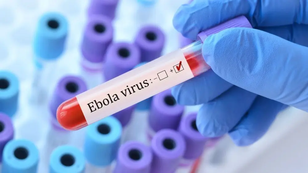 Doctor holding a test blood sample tube with Ebola virus test on the background of medical test tubes with analyzes.