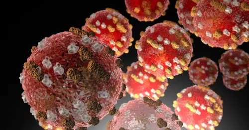 measles