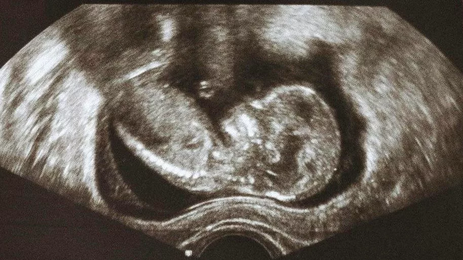 Baby Ultrasound