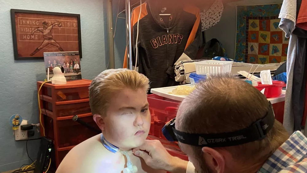 Nathan Hill cares for his son, Brady, 15. For years, Hill said he’s dealt with nurse staffing shortages and he gave up on Idaho’s professional caregiver program. (Courtesy of Nathan Hill)