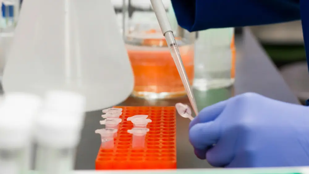 Lab Test
