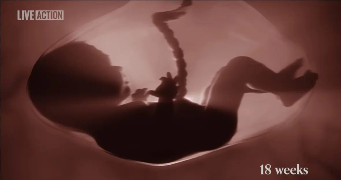 A still image from the Baby Olivia video (LiveAction).