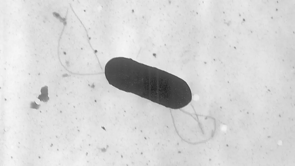 listeria-outbreak