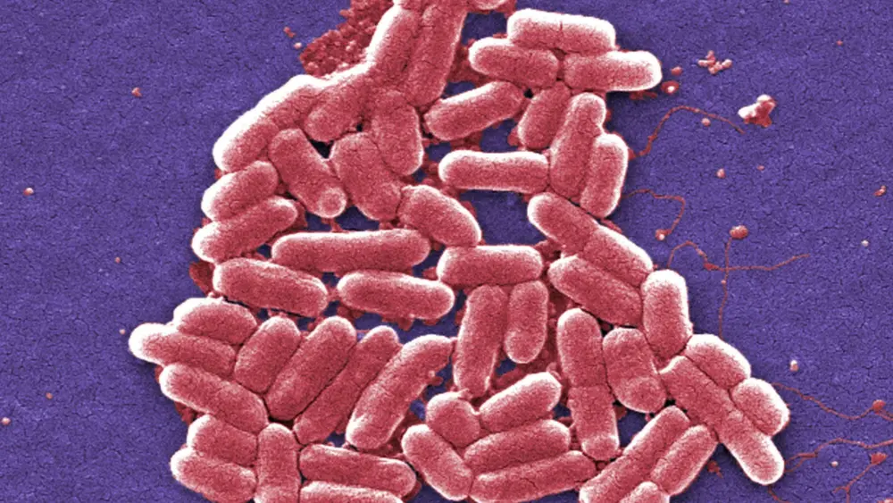 superbug-q-and-a