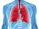 lung-screening