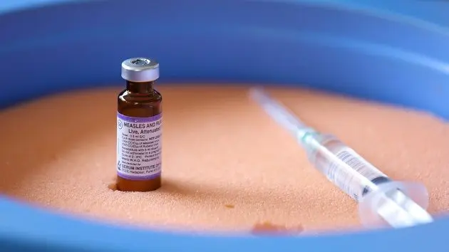 g_measles_032525177614