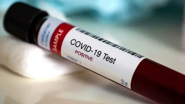 blood-test-samples-for-presence-of-coronavirus-covid-19