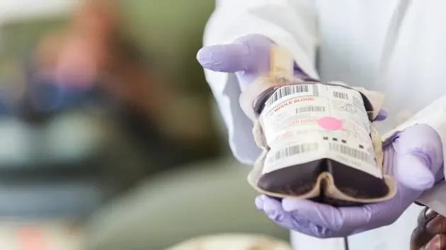 phlebotomist-labeling-bag-of-human-blood-after-donation-in-hospital
