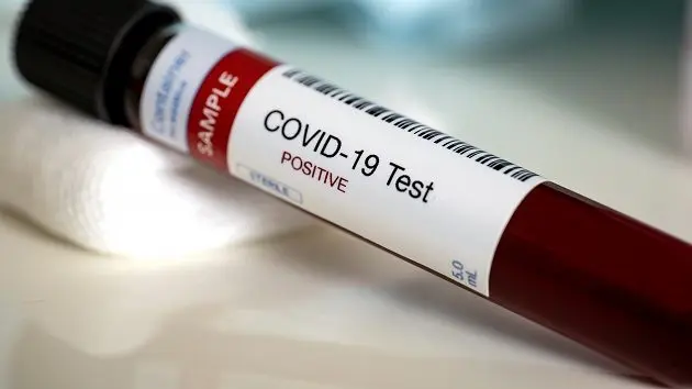 blood-test-samples-for-presence-of-coronavirus-covid-19-3
