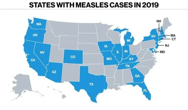 measles-states-e1556141657359