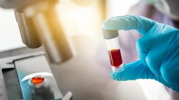 istock_42520_antibodytest