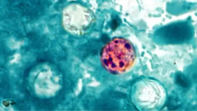 news_cyclospora_7022642240