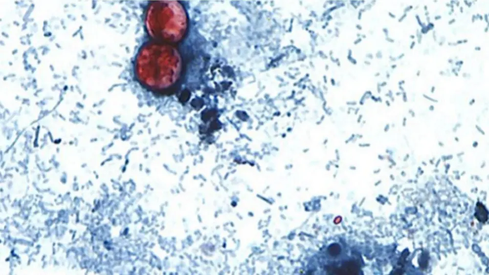cdc_cyclosporiasis_081226982187