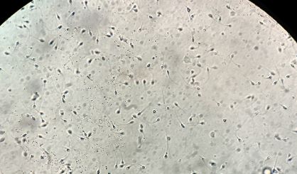 Study Says Sperm Cells' Age May Play Role in Reproductive Success - Vimarsana News