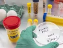 gettyimages_birdflu_042524252041