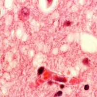 090115_getty_braintissue