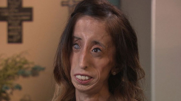 Lizzie Velasquez on Choosing to Fight Bullies: 'I Wanted To Have ...