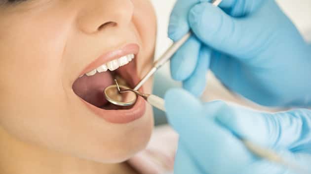 Braces Available For Kids Enrolled In OHP - Vimarsana News