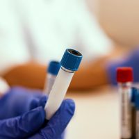 istock_060319_questdiagnosticsdata