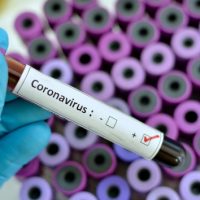 istock_12820_coronaviruspositive-2