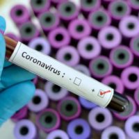 istock_4220_coronavirustubes