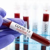 istock_102220_covid19testpos